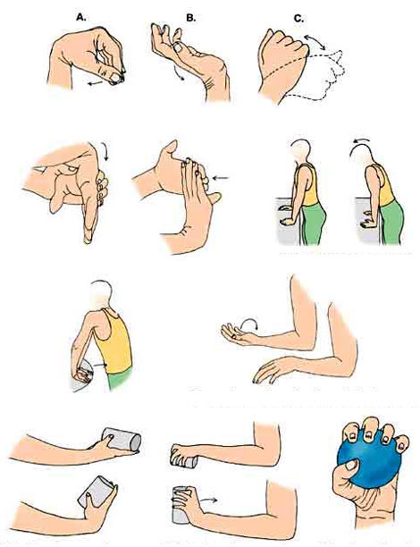 Упражнения для реабилитации после перелома локтевого сустава